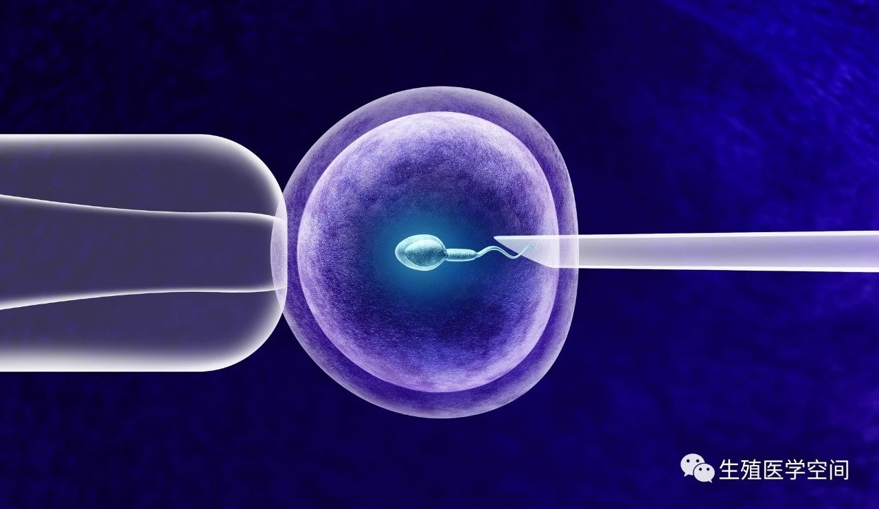 试管婴儿移植后孕酮数值偏高原因分析与处理方案探讨